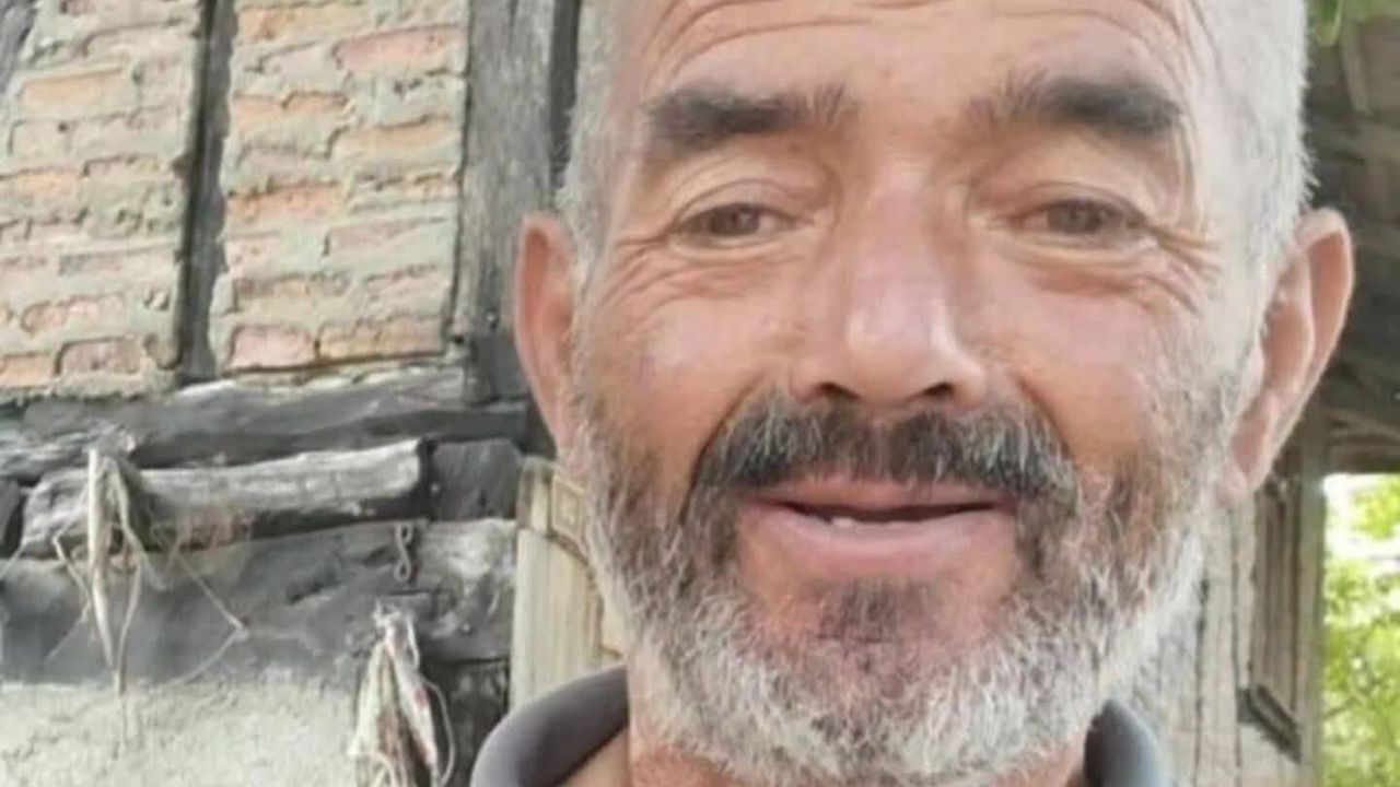 Alzheimer Hastası